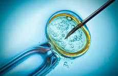 IVF